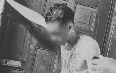 Preocupación en Bello por hombre señalado de robar motocicletas