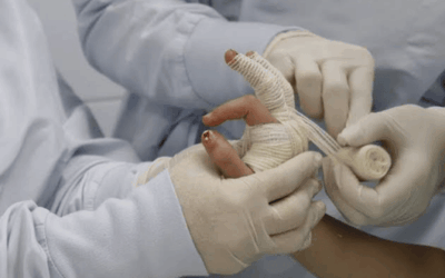 Alcalde Federico Gutiérrez alerta por alarmante cifra de quemados con pólvora en Medellín